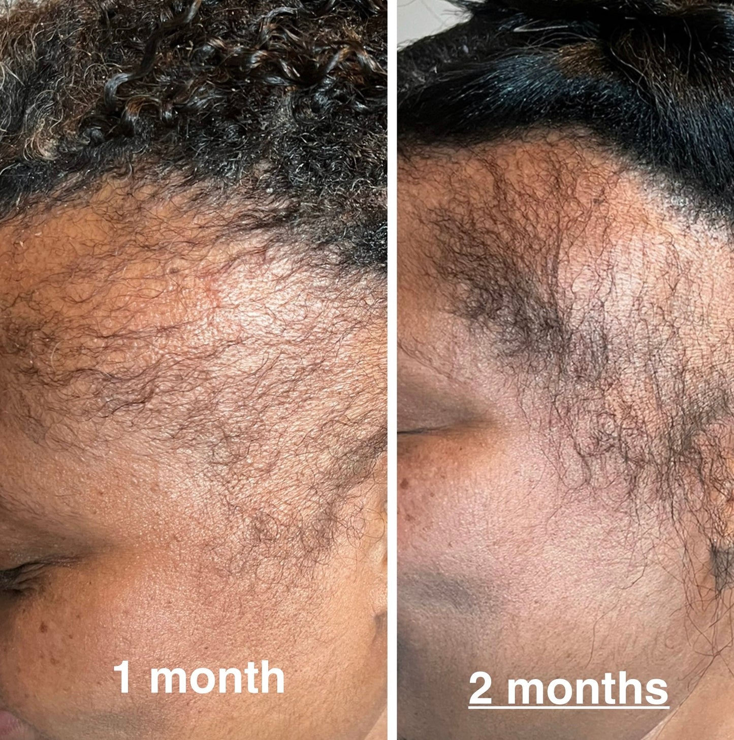ATQ Scalp Serum