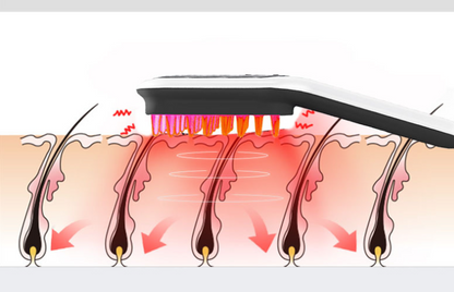 low level laser therapy